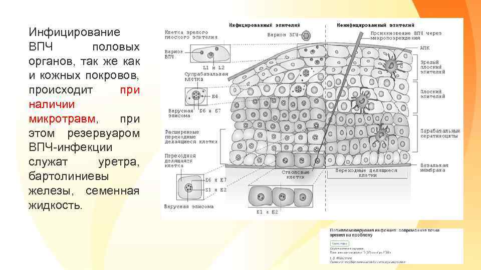 Инфицирование ВПЧ половых органов, так же как и кожных покровов, происходит при наличии микротравм,