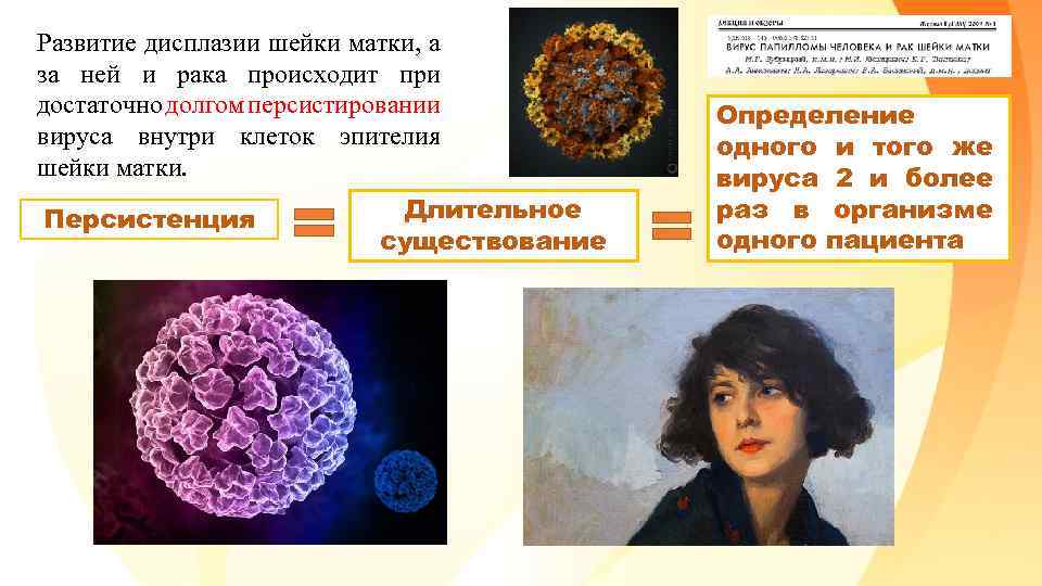 Развитие дисплазии шейки матки, а за ней и рака происходит при достаточно долгом персистировании