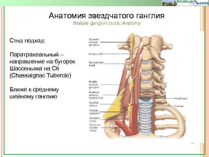 Анатомия звездчатого ганглия Stellate ganglion block: Anatomy Стнд подход: Паратрахеальный – направление на бугорок