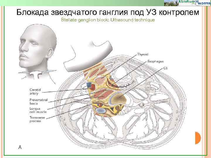 Цервикальный канал картинка