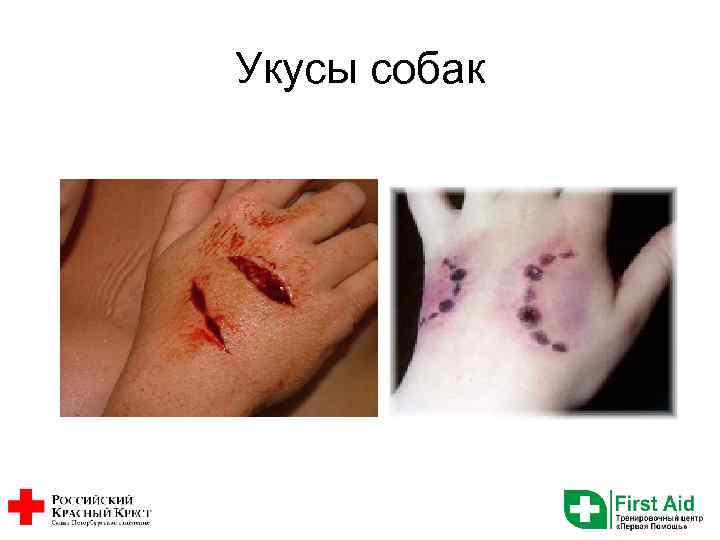 Укусы собак 