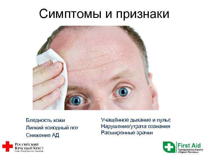 Симптомы и признаки Бледность кожи Липкий холодный пот Снижение АД Учащённое дыхание и пульс