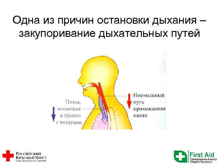 Одна из причин остановки дыхания – закупоривание дыхательных путей 