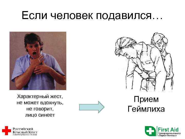 Если человек подавился… Характерный жест, не может вдохнуть, не говорит, лицо синеет Прием Геймлиха