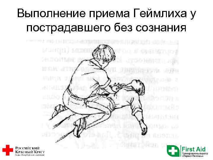 Выполнение приема Геймлиха у пострадавшего без сознания 