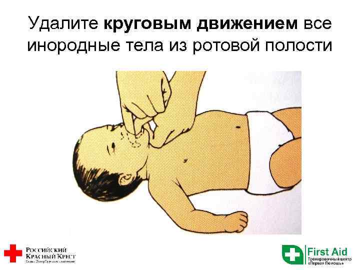 Удалите круговым движением все инородные тела из ротовой полости 