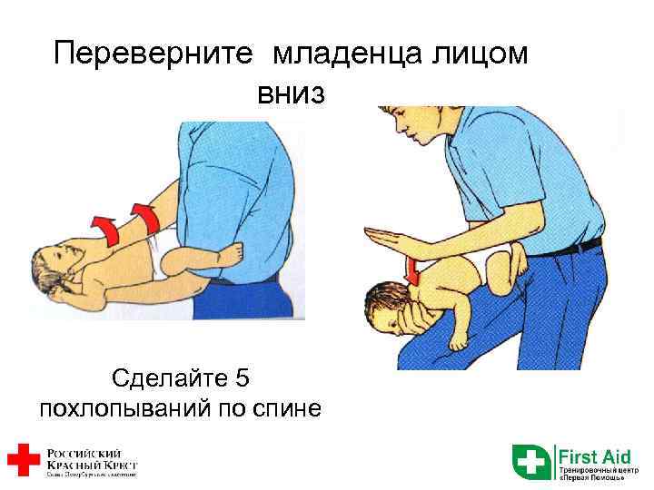 Переверните младенца лицом вниз Сделайте 5 похлопываний по спине 