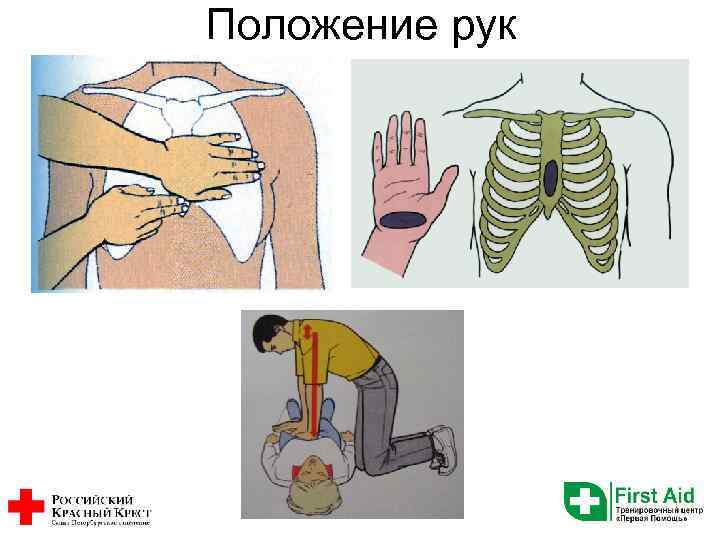 Положение рук 