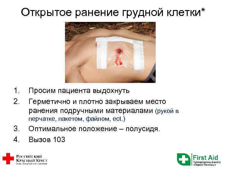 Открытое ранение грудной клетки* 1. 2. Просим пациента выдохнуть Герметично и плотно закрываем место