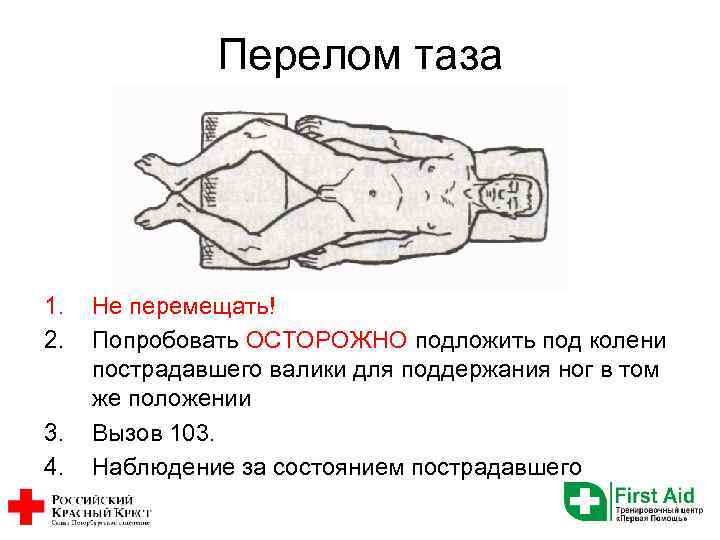 Перелом таза 1. 2. 3. 4. Не перемещать! Попробовать ОСТОРОЖНО подложить под колени пострадавшего