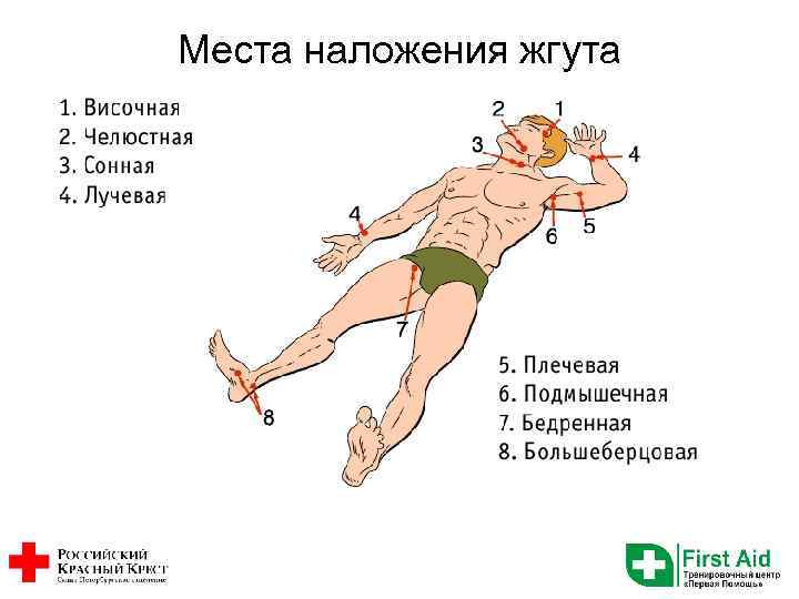 Места наложения жгута 