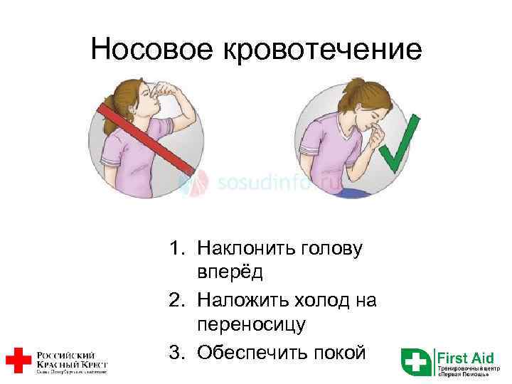 Носовое кровотечение 1. Наклонить голову вперёд 2. Наложить холод на переносицу 3. Обеспечить покой