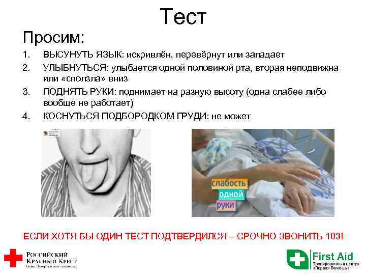 Просим: 1. 2. 3. 4. Тест ВЫСУНУТЬ ЯЗЫК: искривлён, перевёрнут или западает УЛЫБНУТЬСЯ: улыбается