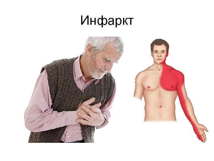 Инфаркт 