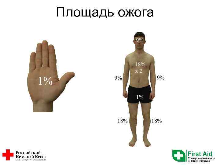 Площадь ожога 