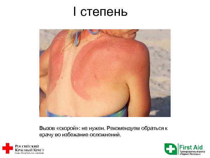 I степень Вызов «скорой» : не нужен. Рекомендуем обраться к врачу во избежание осложнений.