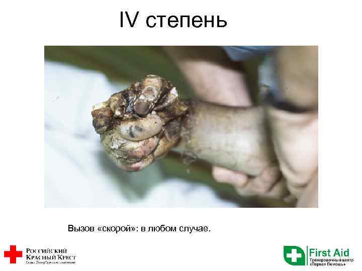 IV степень Вызов «скорой» : в любом случае. 