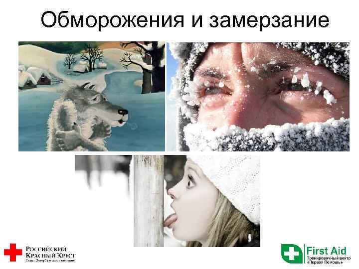 Обморожения и замерзание 