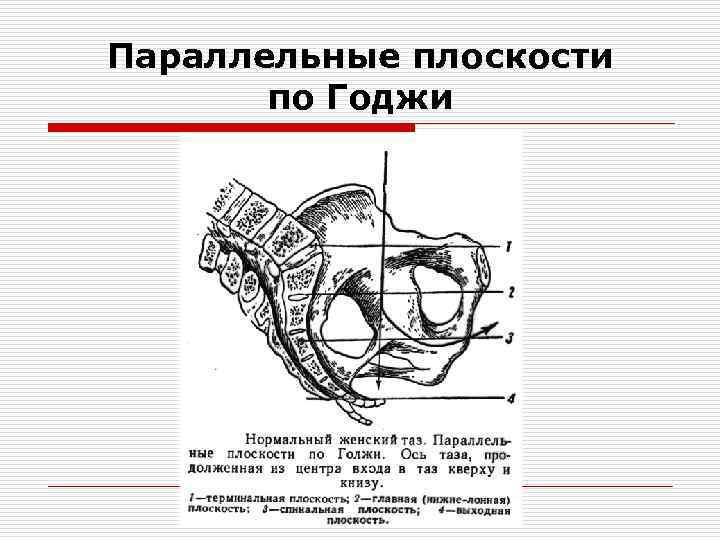 Параллельные плоскости по Годжи 