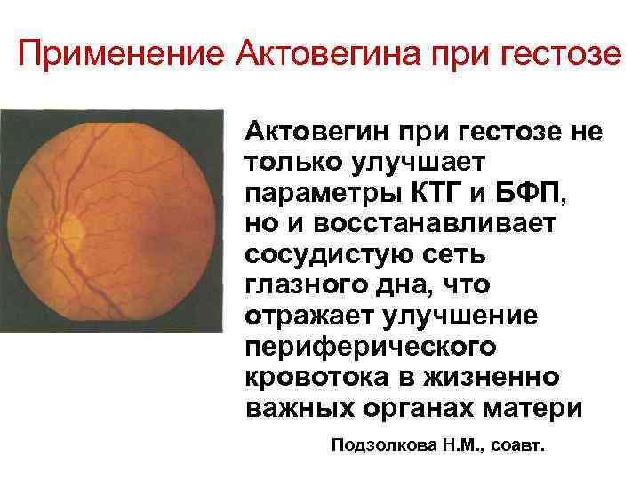 Применение Актовегина при гестозе Актовегин при гестозе не только улучшает параметры КТГ и БФП,