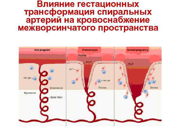 Эндометрий схема. Спиральные маточные артерии. Спиральные артерии матки. Инвазия трофобласта в спиральные артерии. Гестационная трансформация спиральных артерий.