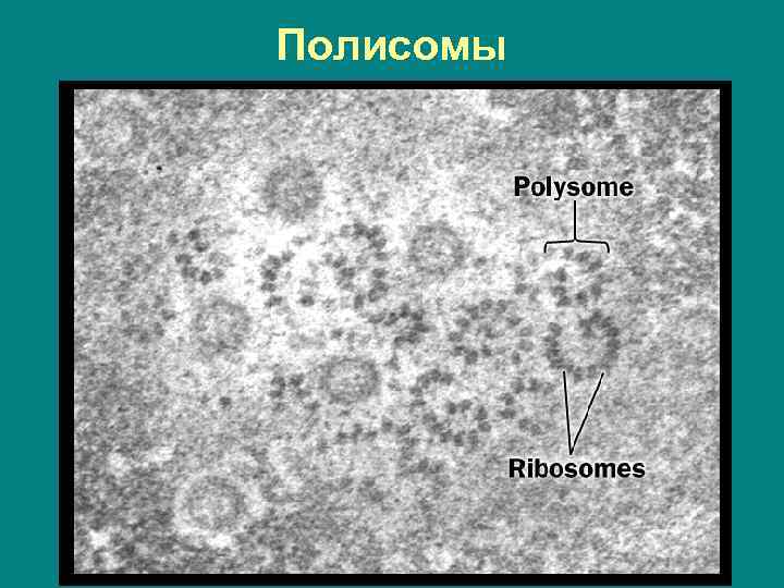 Полисомы 