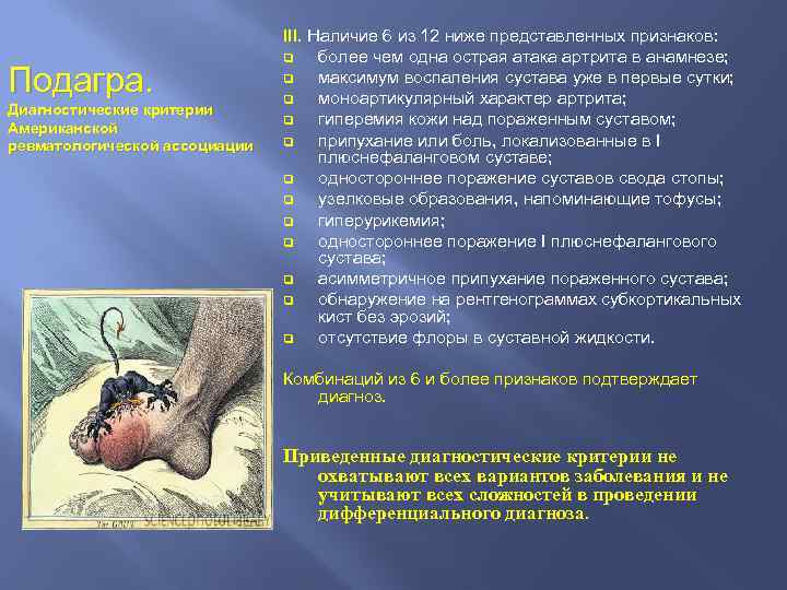 Подагра. Диагностические критерии Американской ревматологической ассоциации III. Наличие 6 из 12 ниже представленных признаков: