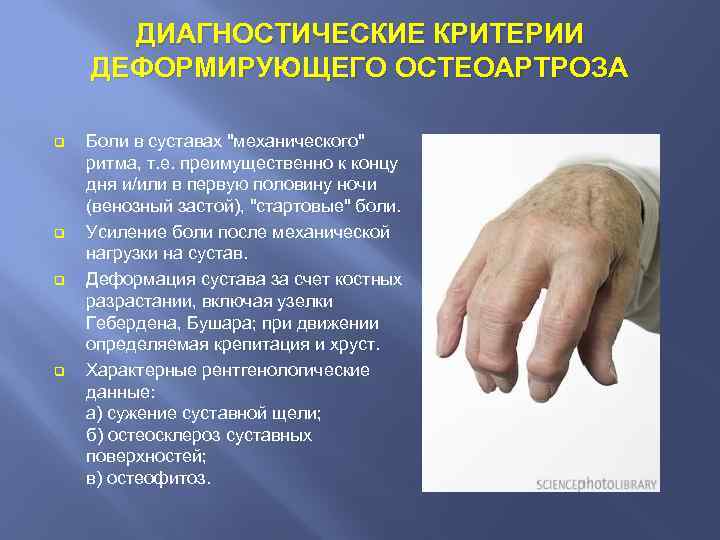 ДИАГНОСТИЧЕСКИЕ КРИТЕРИИ ДЕФОРМИРУЮЩЕГО ОСТЕОАРТРОЗА q q Боли в суставах 