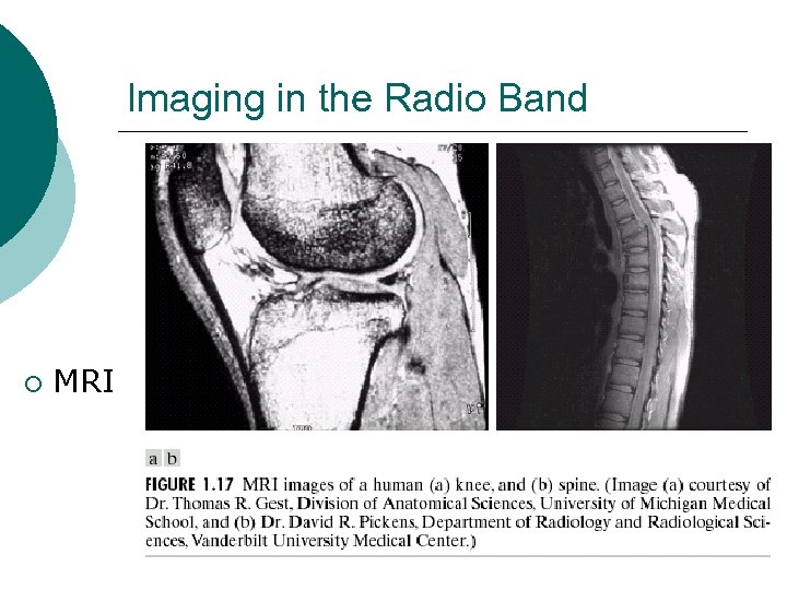 Imaging in the Radio Band ¡ MRI 