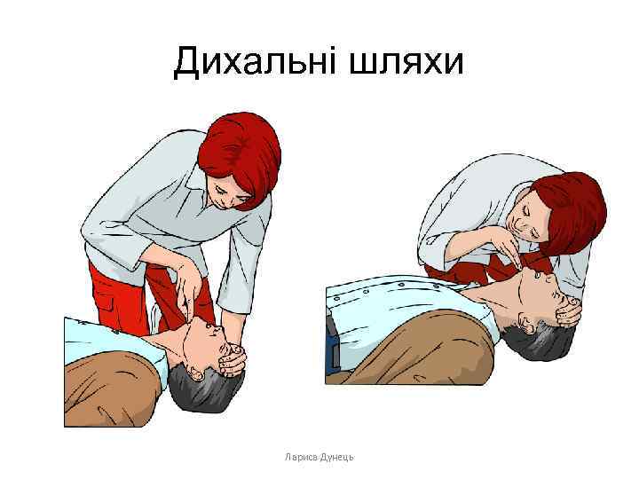 Дихальні шляхи Лариса Дунець 