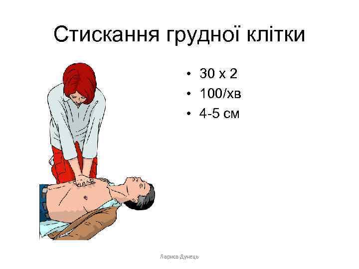 Стискання грудної клітки • 30 х 2 • 100/хв • 4 -5 см Лариса