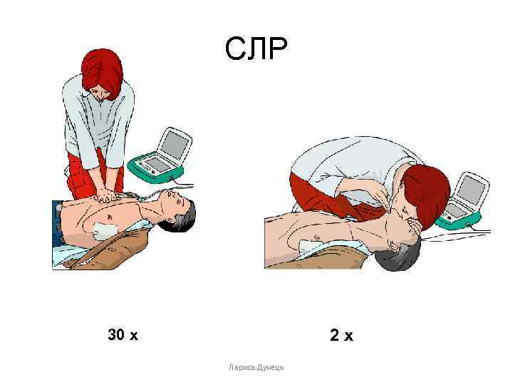 Последовательность сердечно легочной реанимации