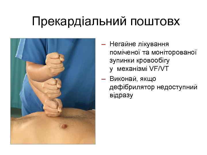 Прекардіальний поштовх – Негайне лікування поміченої та моніторованої зупинки кровообігу у механізмі VF/VT –