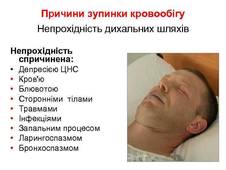 Причини зупинки кровообігу Непрохідність дихальних шляхів Непрохідність спричинена: • • • Депресією ЦНС Кров'ю
