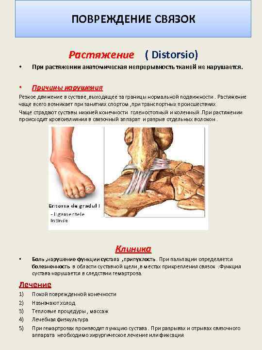 ПОВРЕЖДЕНИЕ СВЯЗОК Растяжение ( Distorsio) • При растяжении анатомическая непрерывность тканей не нарушается. •