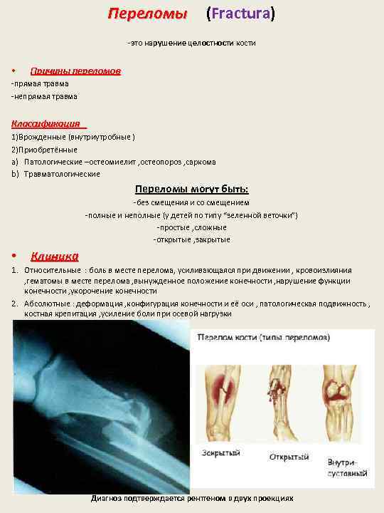 Переломы (Fractura) -это нарушение целостности кости • Причины переломов -прямая травма -непрямая травма Классификация