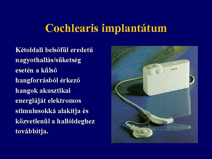 Cochlearis implantátum Kétoldali belsőfül eredetű nagyothallás/süketség esetén a külső hangforrásból érkező hangok akusztikai energiáját