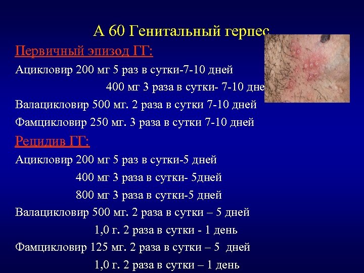 А 60 Генитальный герпес Первичный эпизод ГГ: Ацикловир 200 мг 5 раз в сутки-7