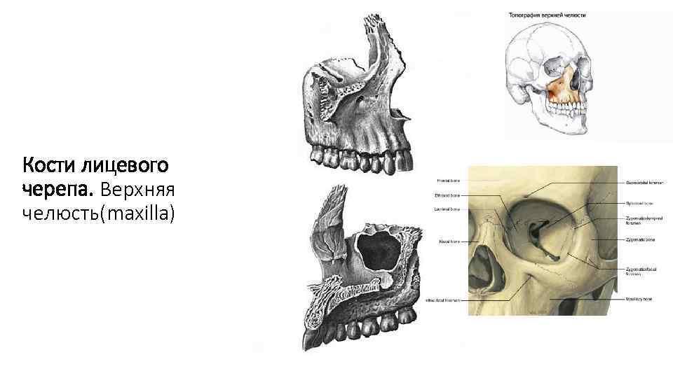 Кости лицевого черепа. Верхняя челюсть(maxilla) 