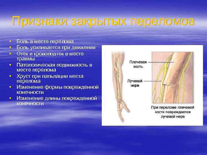 Признаки закрытых переломов § Боль в месте перелома § Боль усиливается при движении §