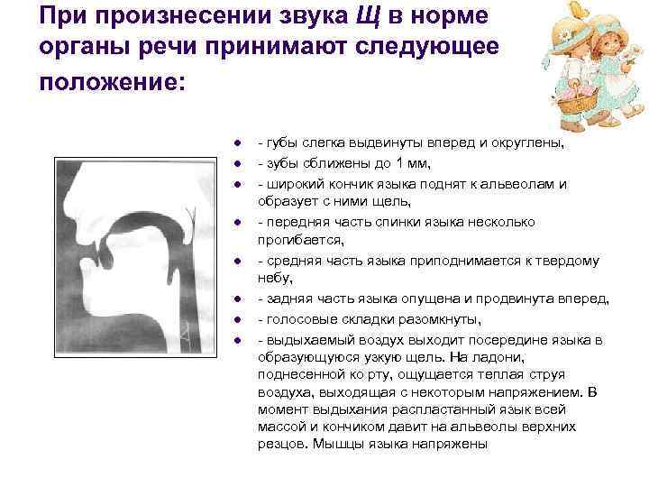 При произнесении звука Щ в норме органы речи принимают следующее положение: l l l