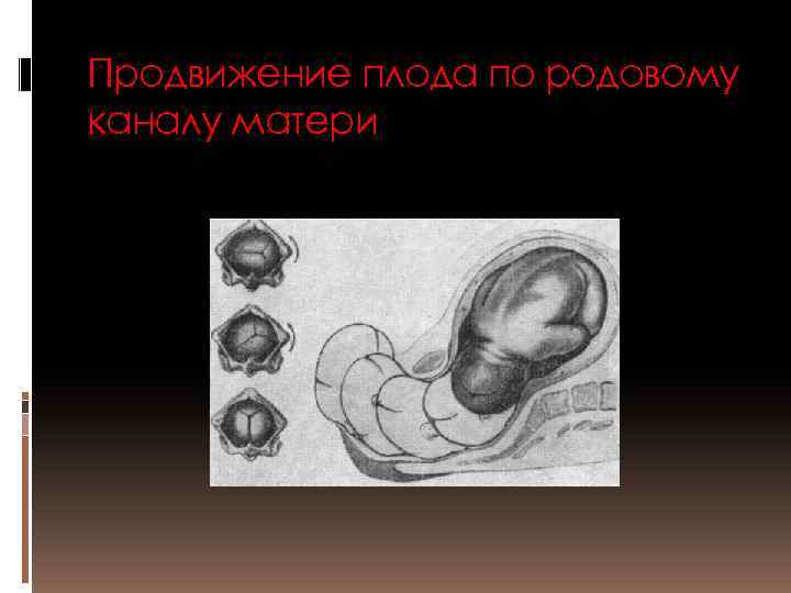 Продвижение плода по родовому каналу матери 