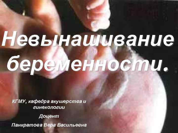 Невынашивание беременности. КГМУ, кафедра акушерства и гинекологии Доцент Панкратова Вера Васильевна 