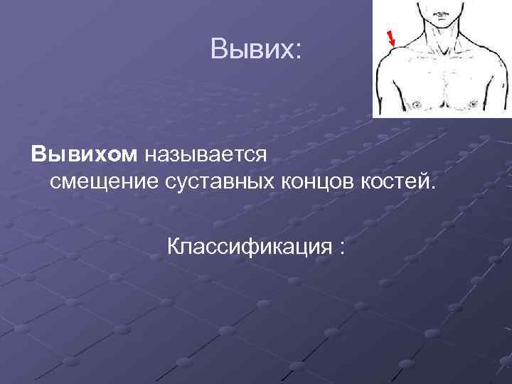 Вывих: Вывихом называется смещение суставных концов костей. Классификация : 