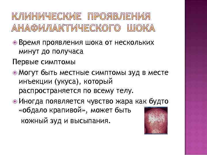  Время проявления шока от нескольких минут до получаса Первые симптомы Могут быть местные