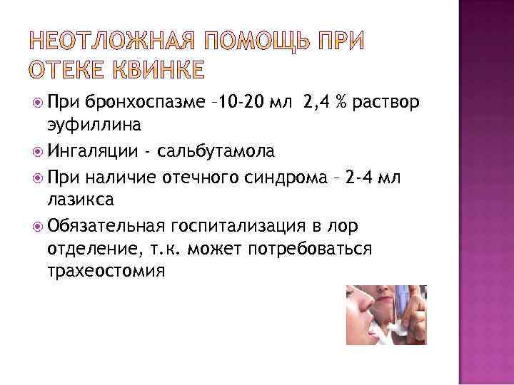  При бронхоспазме – 10 -20 мл 2, 4 % раствор эуфиллина Ингаляции -