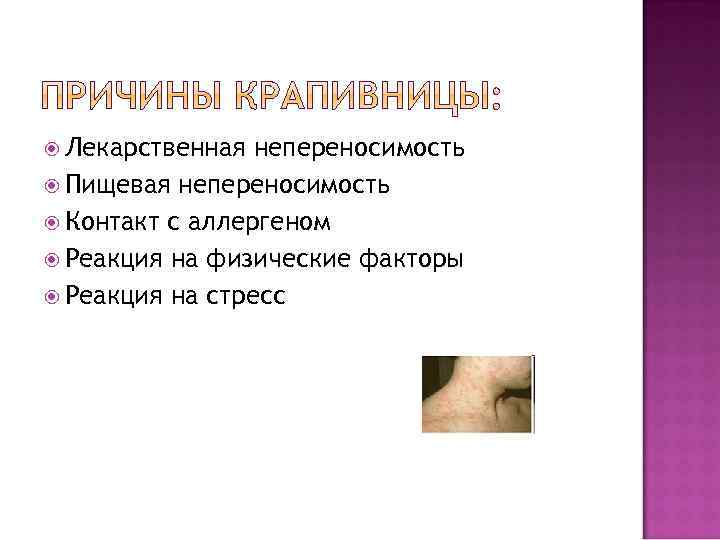  Лекарственная непереносимость Пищевая непереносимость Контакт с аллергеном Реакция на физические факторы Реакция на