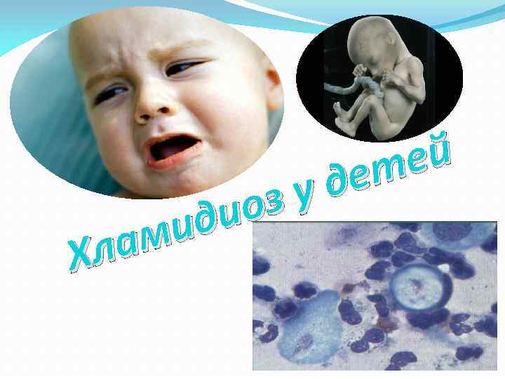 оз ди ми ла Х ей ет уд 