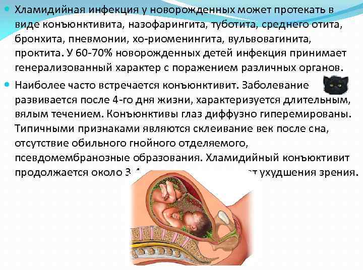  Хламидийная инфекция у новорожденных может протекать в виде конъюнктивита, назофарингита, туботита, среднего отита,