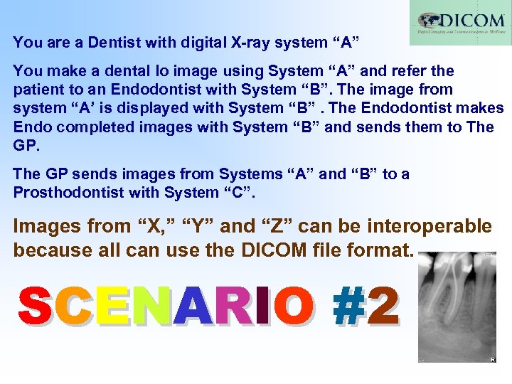You are a Dentist with digital X-ray system “A” You make a dental Io
